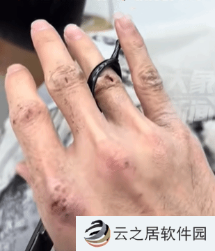 25岁理发师双手与脸形成巨大反差 网友